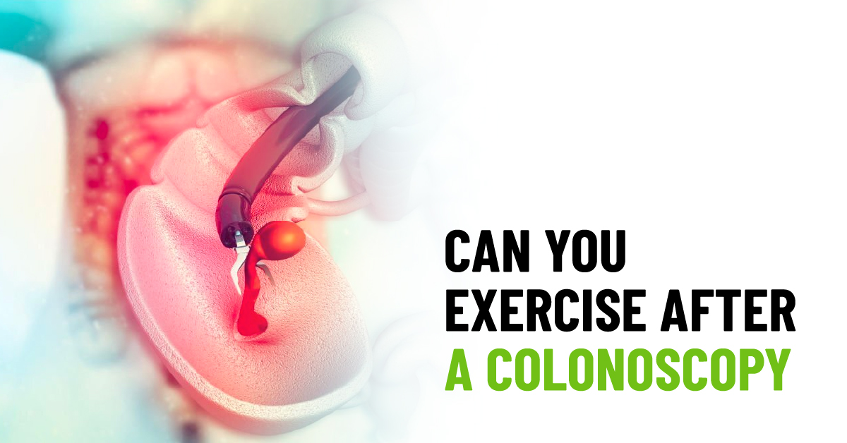 Can You Exercise After a Colonoscopy